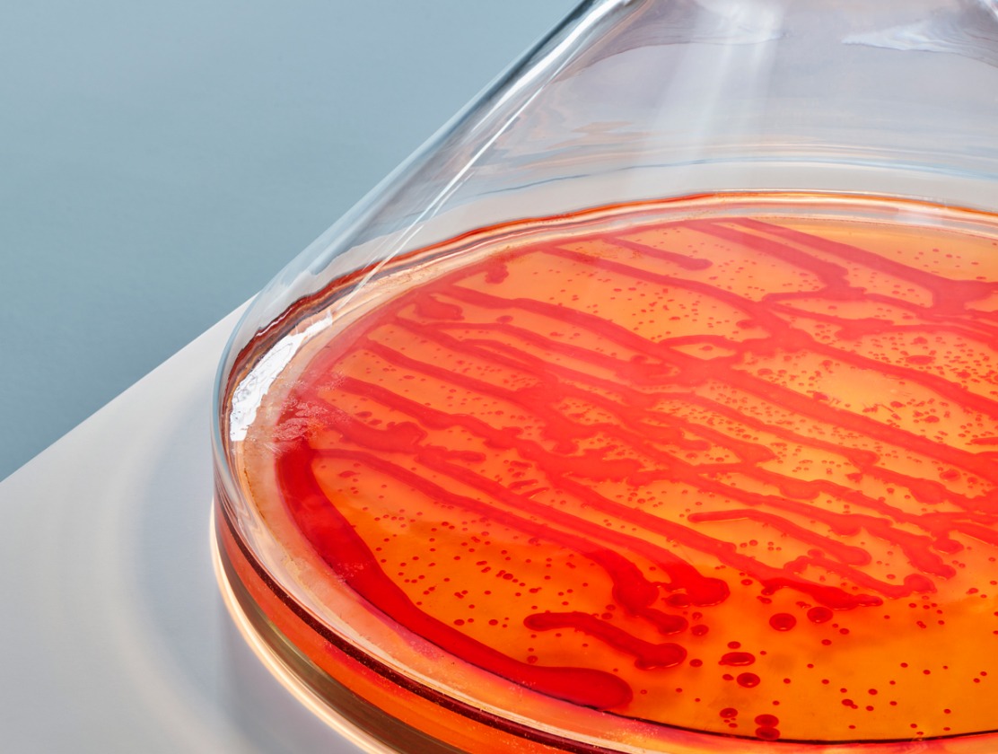 Eine Petrischale mit einer orangefarbenen Flüssigkeit und tiefroten Bakterienstämmen, die ein interessantes Muster erzeugen.